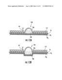 BLISTER PACKAGES WITH FRAMES FOR DRY POWDER DRUG CONTAINMENT diagram and image