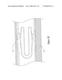 Shock-absorbing structure for storage apparatus diagram and image