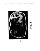 Non-Invasive Mri Measurement of Tissue Glycogen diagram and image