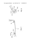 Rimless spectacles diagram and image