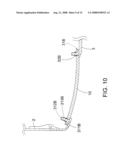 Rimless spectacles diagram and image