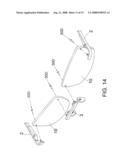 Rimless spectacles diagram and image