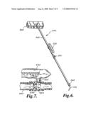 Window cleaning apparatus with deionization cartridge diagram and image