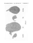 Antiestrogenic glyceollins suppress human breast and ovarian carcinoma proliferation and tumorigenesis diagram and image