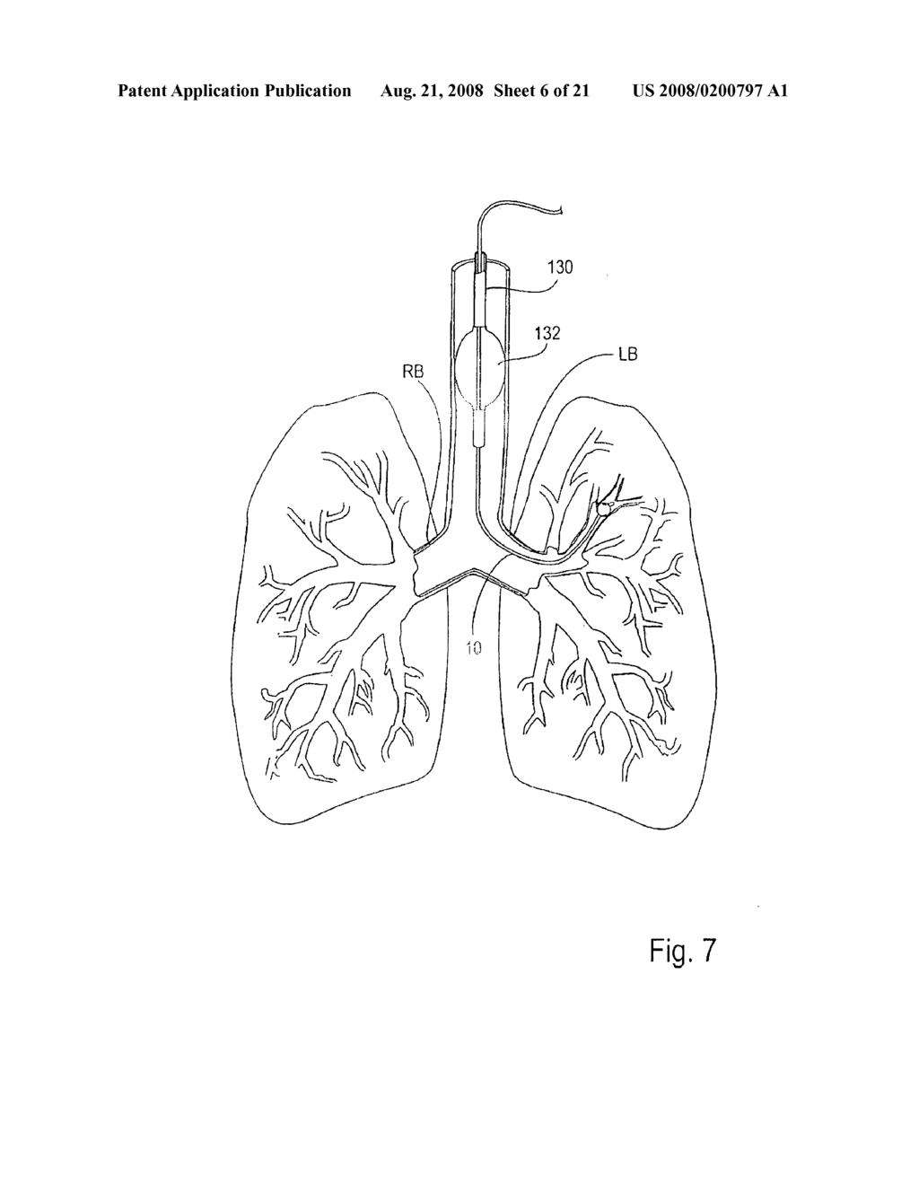 METHOD AND APPARATUS FOR ENDOBRONCHIAL DIAGNOSIS - diagram, schematic, and image 07