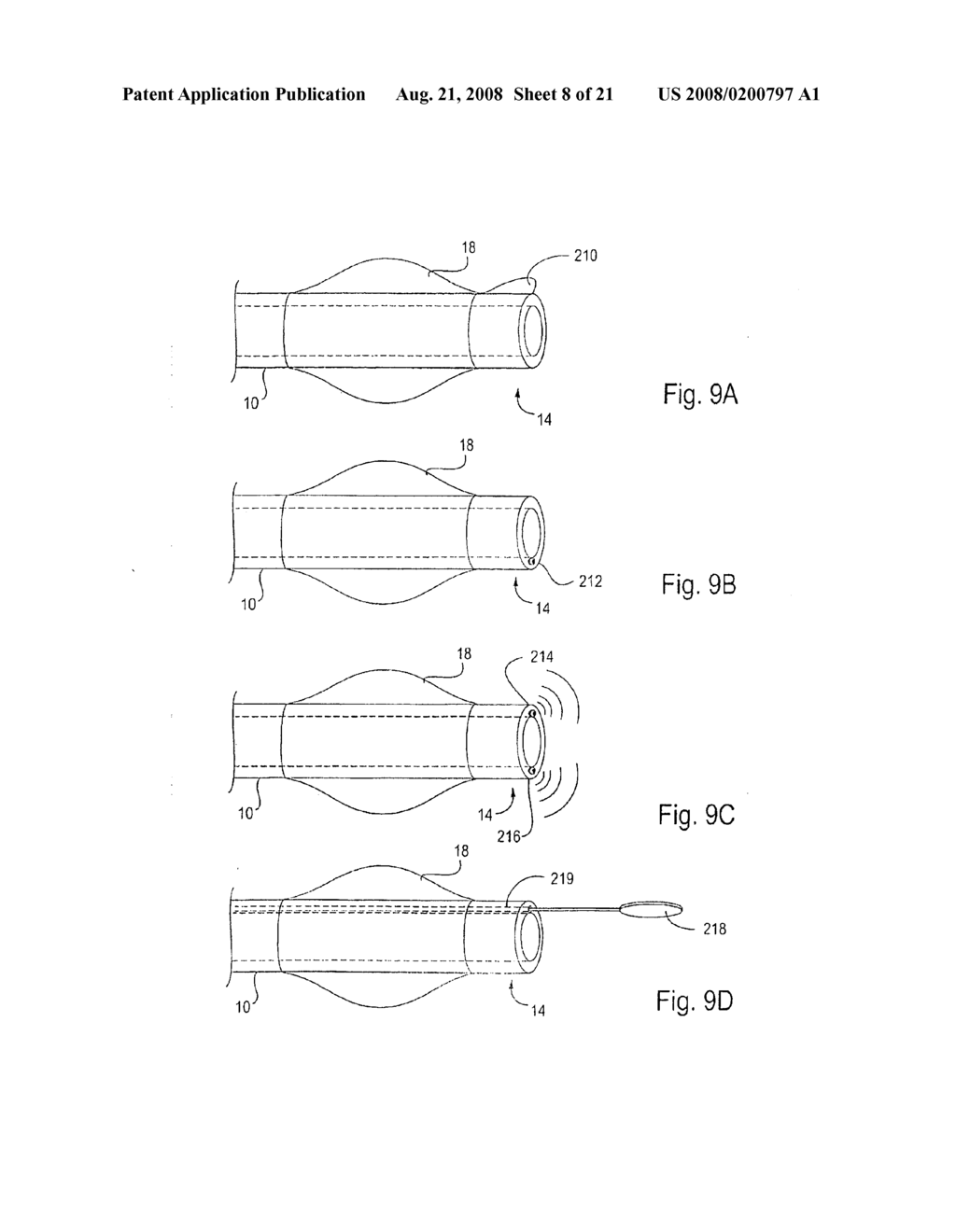 METHOD AND APPARATUS FOR ENDOBRONCHIAL DIAGNOSIS - diagram, schematic, and image 09