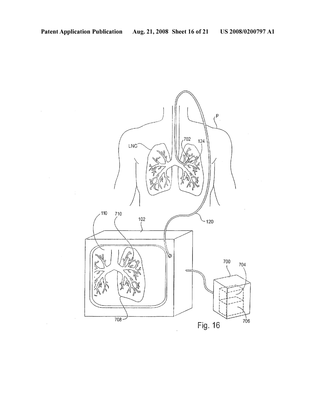 METHOD AND APPARATUS FOR ENDOBRONCHIAL DIAGNOSIS - diagram, schematic, and image 17