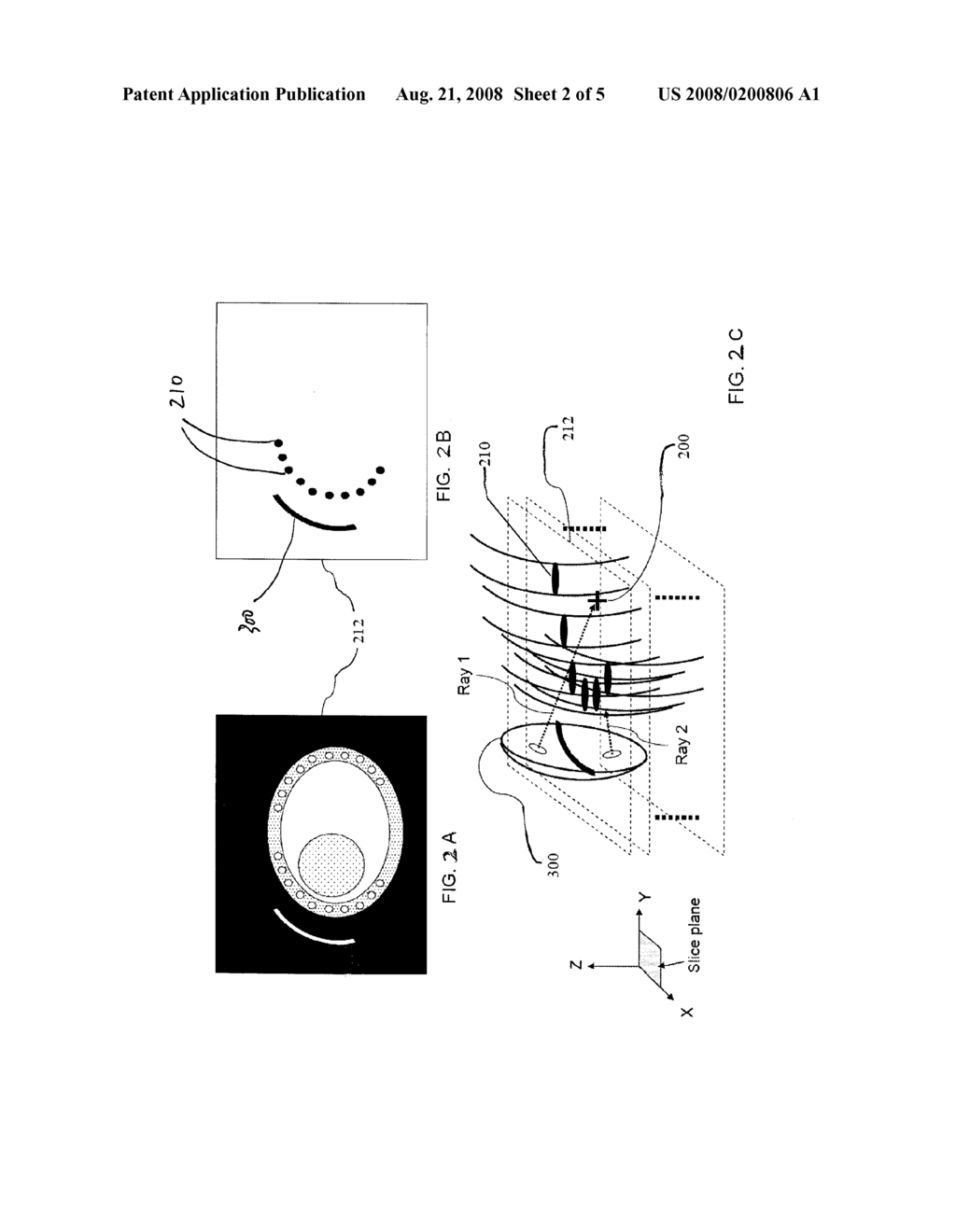 Medical Treatment Using An Ultrasound Phased Array - diagram, schematic, and image 03