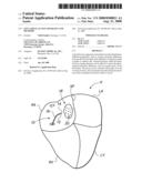 LEFT ATRIAL ACCESS APPARATUS AND METHODS diagram and image