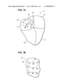 LEFT ATRIAL ACCESS APPARATUS AND METHODS diagram and image