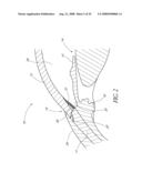 SYSTEM FOR TREATING OCULAR DISORDERS AND METHODS THEREOF diagram and image