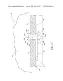 SYSTEM FOR TREATING OCULAR DISORDERS AND METHODS THEREOF diagram and image