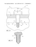 SYSTEM FOR TREATING OCULAR DISORDERS AND METHODS THEREOF diagram and image