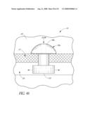 SYSTEM FOR TREATING OCULAR DISORDERS AND METHODS THEREOF diagram and image