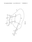 Electrical ablation apparatus, system, and method diagram and image