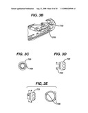 ULTRASONIC DEVICE FOR CUTTING AND COAGULATING diagram and image