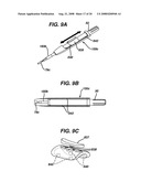 ULTRASONIC DEVICE FOR CUTTING AND COAGULATING diagram and image