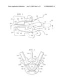 NUCLEUS REPLACEMENT SECURING DEVICE AND METHOD diagram and image