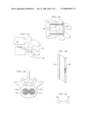 NUCLEUS REPLACEMENT SECURING DEVICE AND METHOD diagram and image