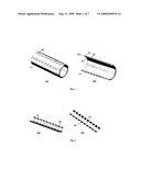 CARBON STENTS diagram and image