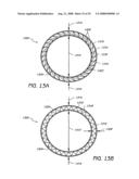 ADJUSTABLE CARDIAC VALVE IMPLANT WITH COUPLING MECHANISM diagram and image