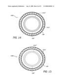 ADJUSTABLE CARDIAC VALVE IMPLANT WITH COUPLING MECHANISM diagram and image