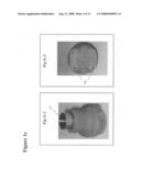 Percutaneous implant for limb salvage diagram and image