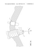 COMBUSTION CONTROL METHOD FOR A DIRECT-INJECTION CONTROLLED AUTO-IGNITION COMBUSTION ENGINE diagram and image