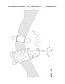 COMBUSTION CONTROL METHOD FOR A DIRECT-INJECTION CONTROLLED AUTO-IGNITION COMBUSTION ENGINE diagram and image