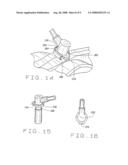 Sensor Assembly diagram and image