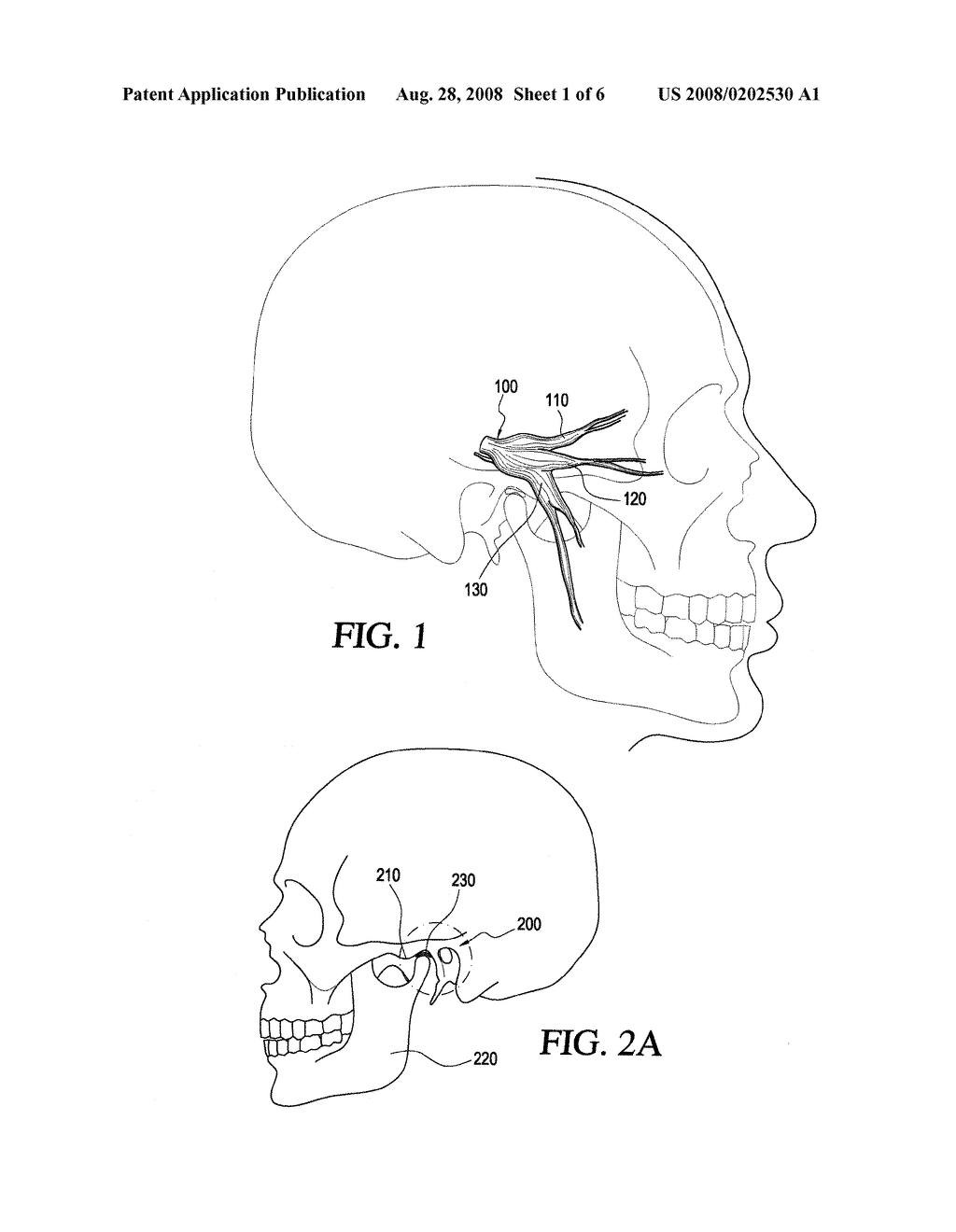 Device and Method for the Treatment of Movement Disorders - diagram, schematic, and image 02