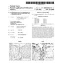 Blockade of Elr+Cxc Chemokines as a Treatment For Inflammatory and Autoimmune Disease diagram and image