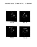 Functionalized Magnetic Nanoparticles and Methods of Use Thereof diagram and image