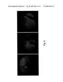 METHOD, DYE AND MEDICAMENT FOR STAINING THE INTERNAL LIMITING MEMBRANE, EPIRETINAL MEMBRANE, THE VITREOUS AND/OR THE CAPSULE OF AN EYE diagram and image