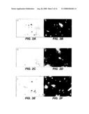 BONE MARROW-DERIVED NEURONAL CELLS diagram and image