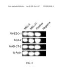 PROSTATE CANCER AND MELANOMA ANTIGENS diagram and image