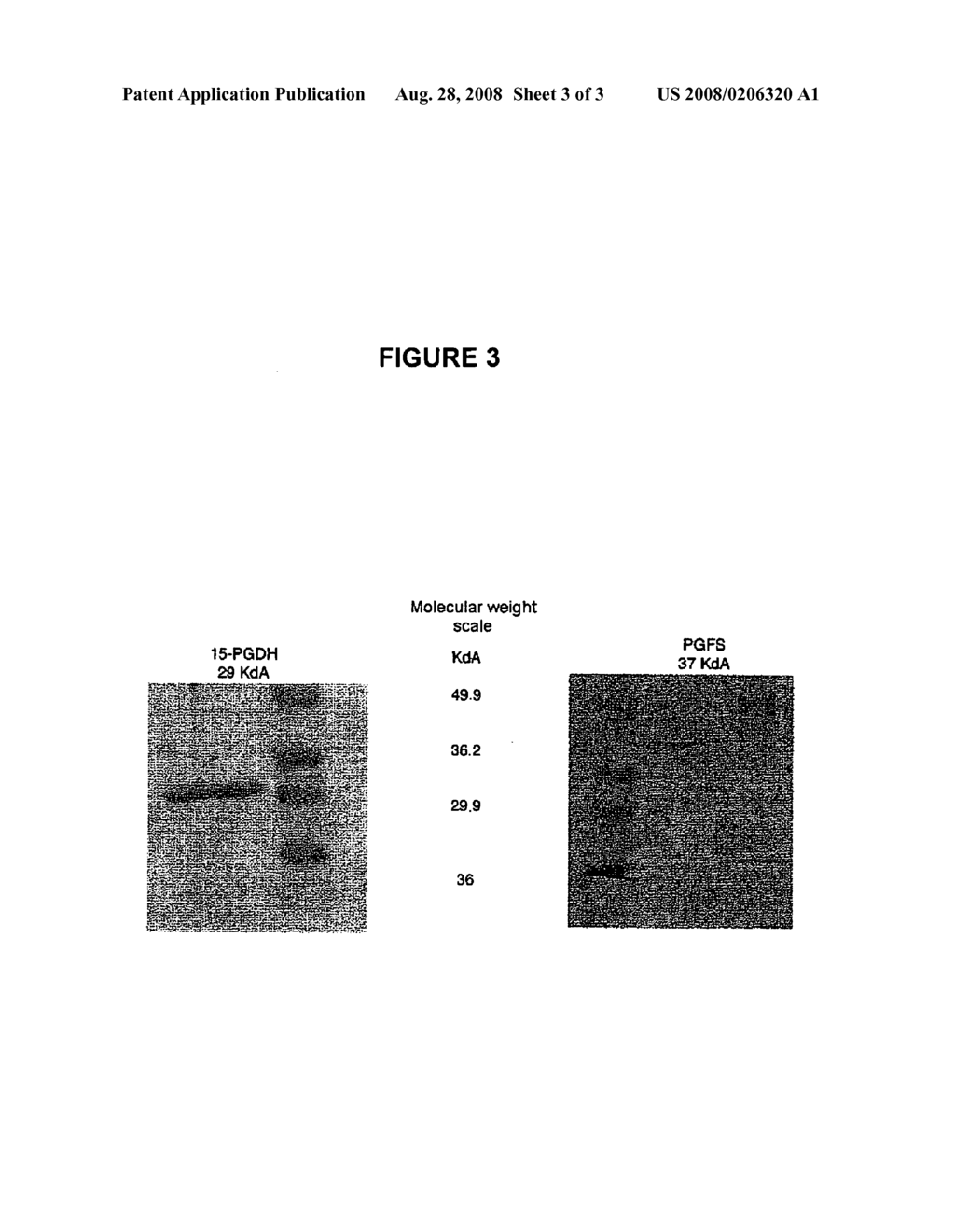 COMPOSITION COMPRISING AT LEAST ONE 15-PGDH INHIBITOR - diagram, schematic, and image 04