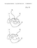 Dental Prosthesis and Its Manufacturing Method diagram and image