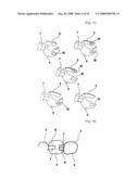 Dental Prosthesis and Its Manufacturing Method diagram and image