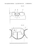 Dental Prosthesis and Its Manufacturing Method diagram and image