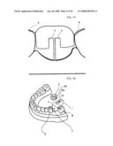 Dental Prosthesis and Its Manufacturing Method diagram and image