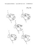 Dental Prosthesis and Its Manufacturing Method diagram and image