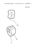 Dental Prosthesis and Its Manufacturing Method diagram and image