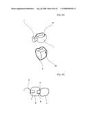 Dental Prosthesis and Its Manufacturing Method diagram and image