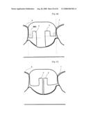 Dental Prosthesis and Its Manufacturing Method diagram and image