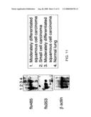 Novel fetal genes diagram and image