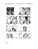 Use of CCN5 for treatment of smooth muscle proliferation disorders diagram and image