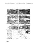 Use of CCN5 for treatment of smooth muscle proliferation disorders diagram and image