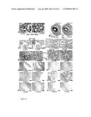 Use of CCN5 for treatment of smooth muscle proliferation disorders diagram and image