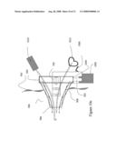 OPTO-ELECTRONIC ILLUMINATION AND VISION MODULE FOR ENDOSCOPY diagram and image